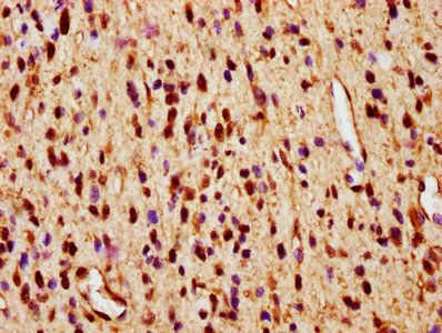 SMAD1 Antibody