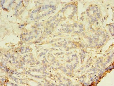 SMAD1 Antibody