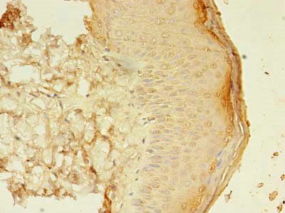 SMAD1 antibody