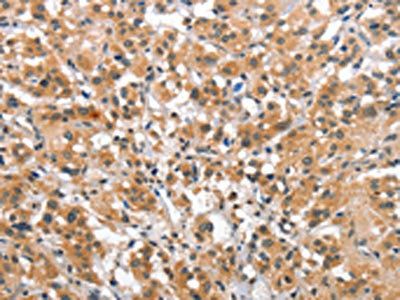 SMAD1 Antibody