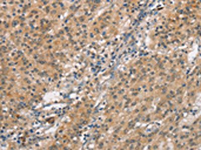 SMAD1 Antibody
