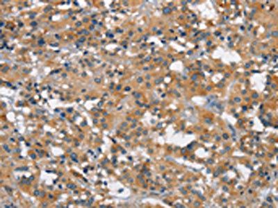 SMAD1 Antibody