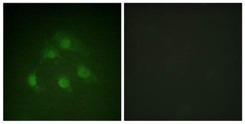 Smad1 (Ab-187) Antibody