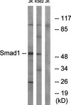 Smad1 (Ab-187) Antibody