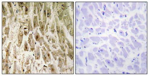 Smad1 (Ab-465) Antibody