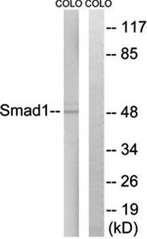 Smad1 (Ab-465) Antibody