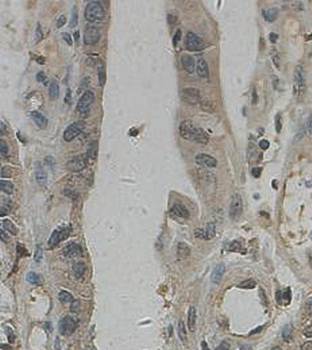 SMAD1 Rabbit Polyclonal Antibody