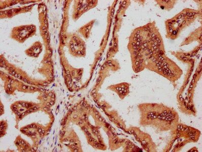 SMAD2 Antibody