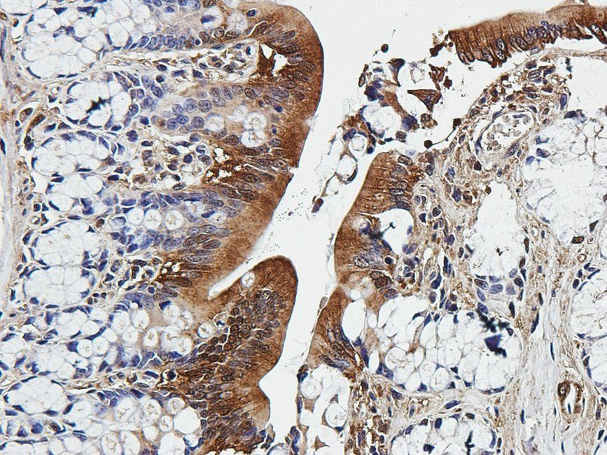 SMAD2 antibody