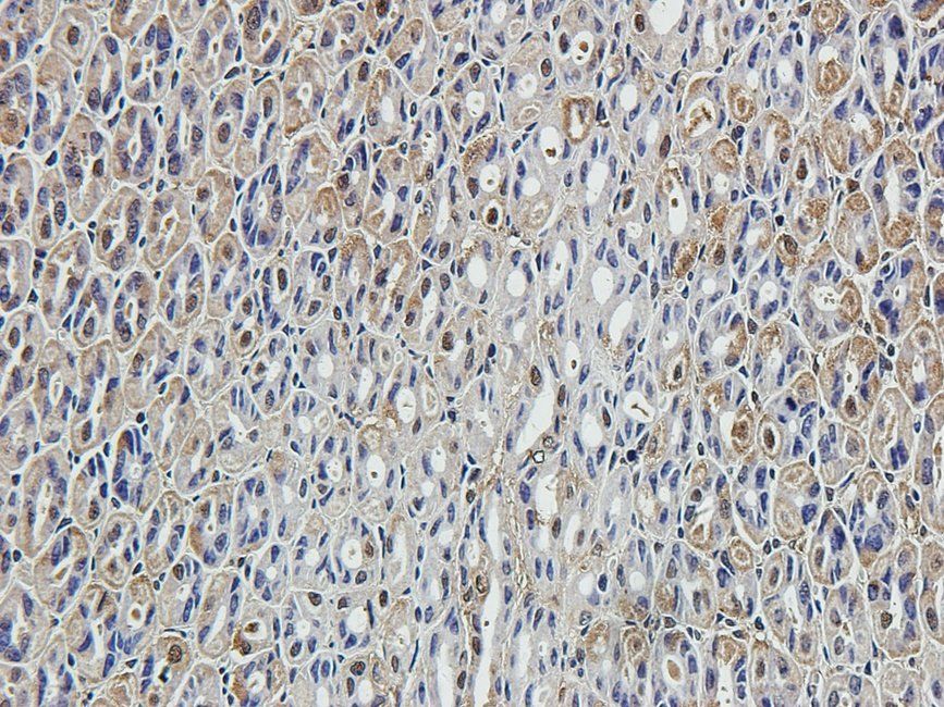 SMAD2 antibody