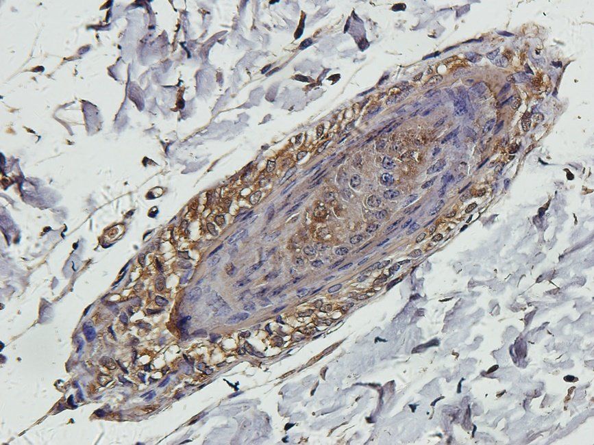 SMAD2 antibody