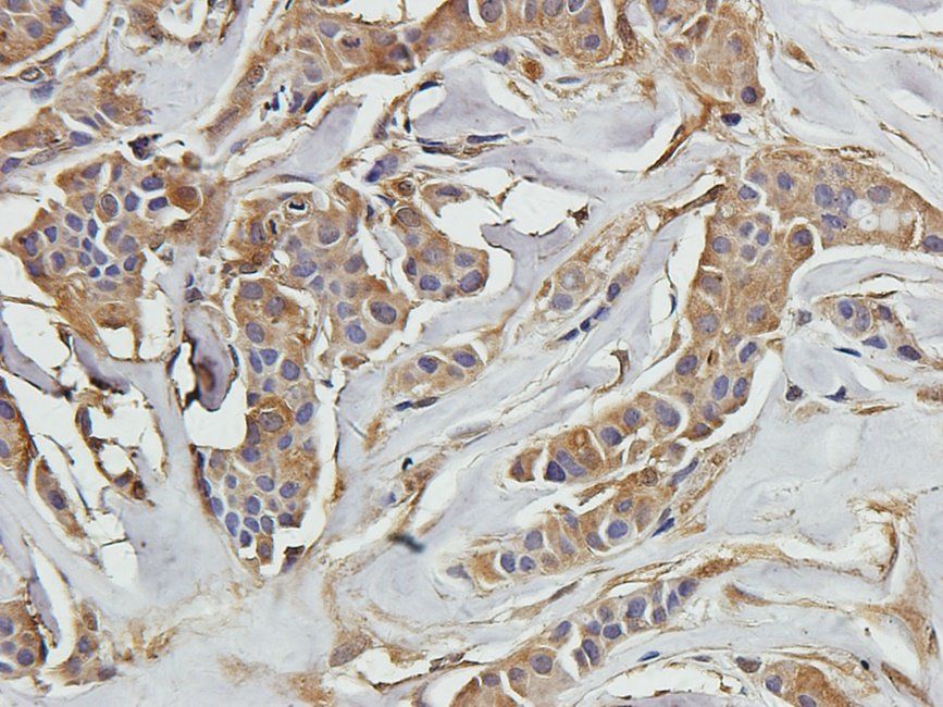 SMAD2 antibody