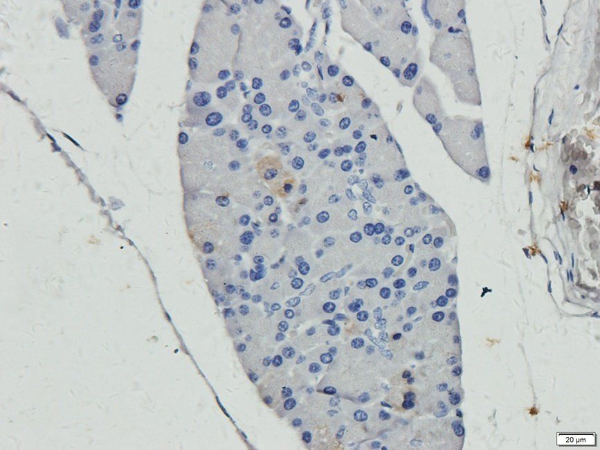 SMAD2 antibody