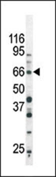 SMAD3 (phospho-Ser213) antibody