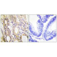 SMAD3 Antibody