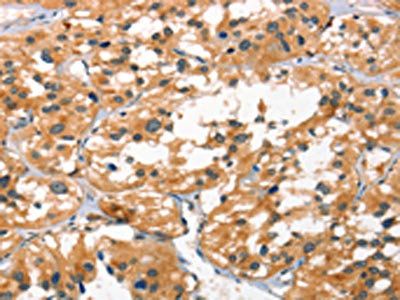 SMAD3 Antibody