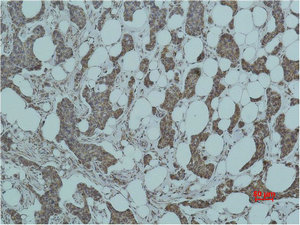 SMAD3 Antibody