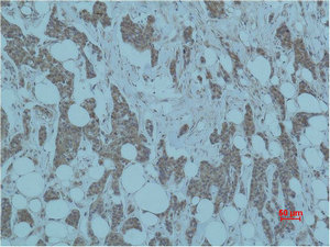 SMAD3 Antibody