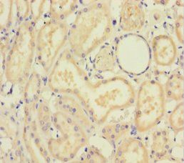 SMAD4 Antibody