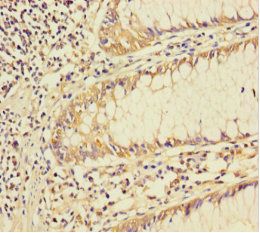 SMAD4 Antibody
