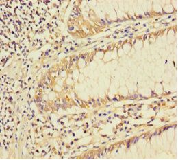 SMAD4 antibody