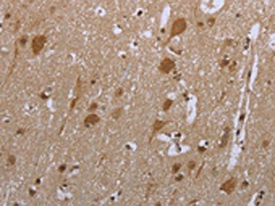 SMAD4 Antibody