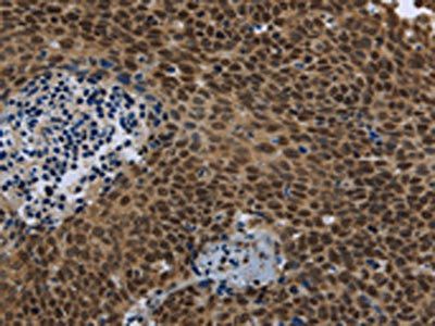 SMAD4 Antibody