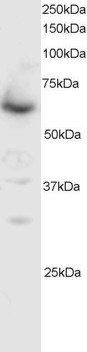 SMAD4/MADH4 Antibody