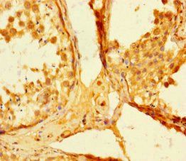 SMAD5 Antibody