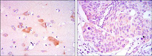 SMAD5 Antibody