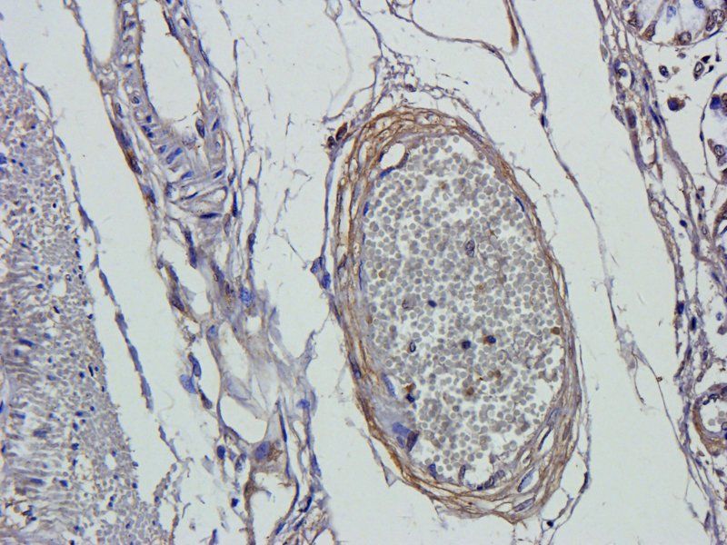 Smad7 antibody