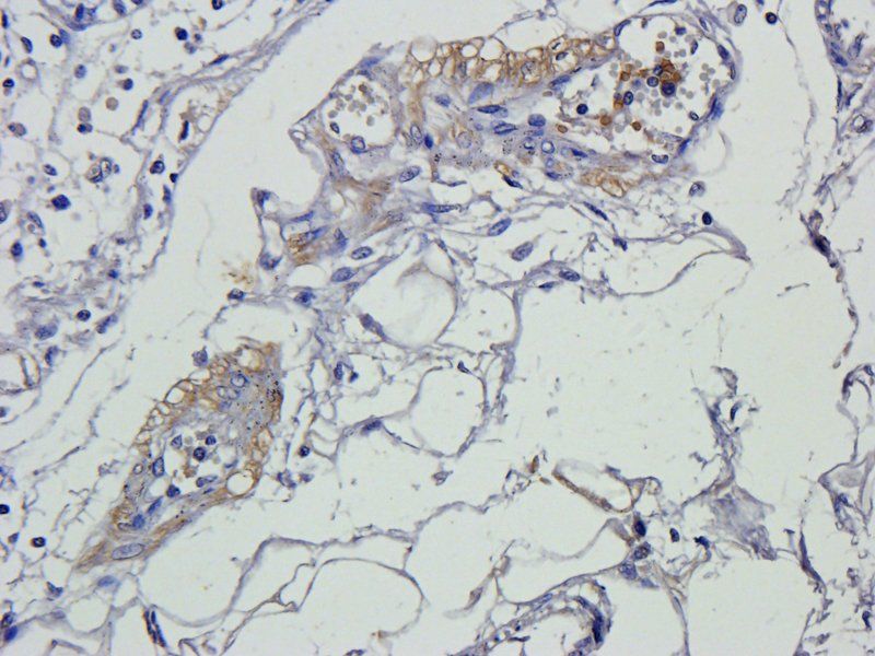 Smad7 antibody