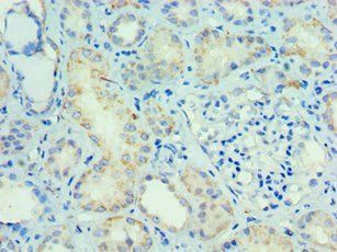 SMAD9 antibody