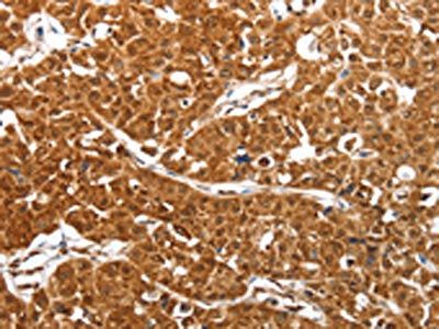SMARCA4 Antibody
