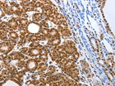 SMARCA4 Antibody