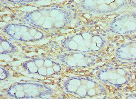 SMARCC2 Antibody