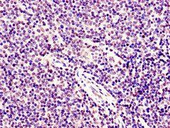 SMARCD1 Antibody