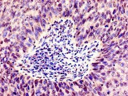SMARCD1 Antibody