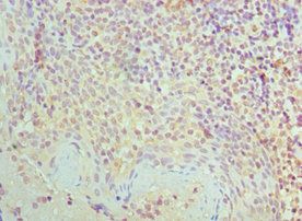 SMC1A Antibody