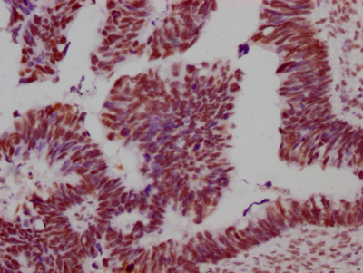 SMC1A Recombinant Monoclonal Antibody