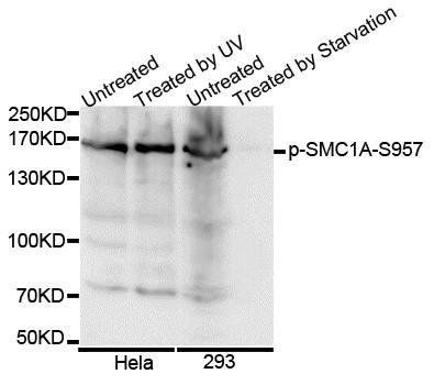 SMC1A (phospho-S957) antibody