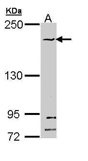 SMC1B antibody