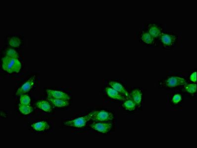 SMC4 antibody