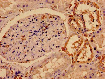 SMC4 antibody