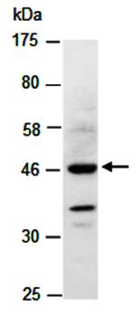 SMDF (N) Antibody, Rabbit Polyclonal