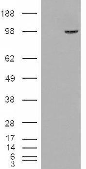 Goat anti-SMEK1 / KIAA2010 Antibody