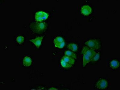 SMG6 Antibody