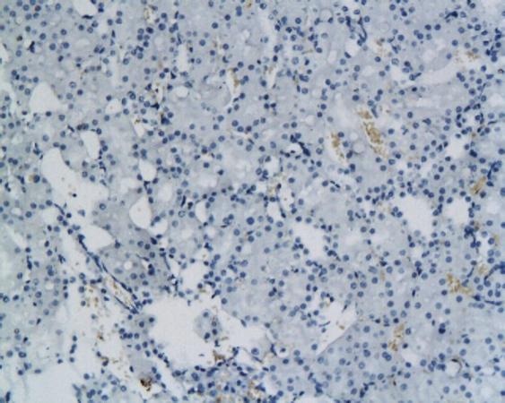 SMMHC antibody