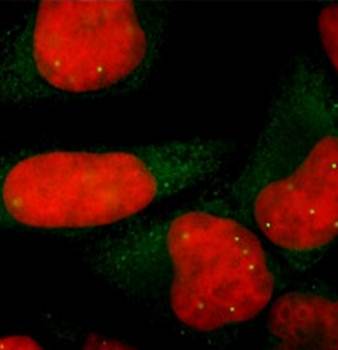 SMN/Gemin-1 Monoclonal Antibody