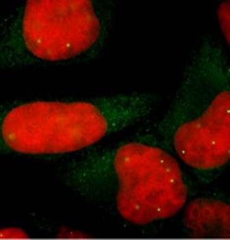 SMN/Gemin-1 Monoclonal Antibody
